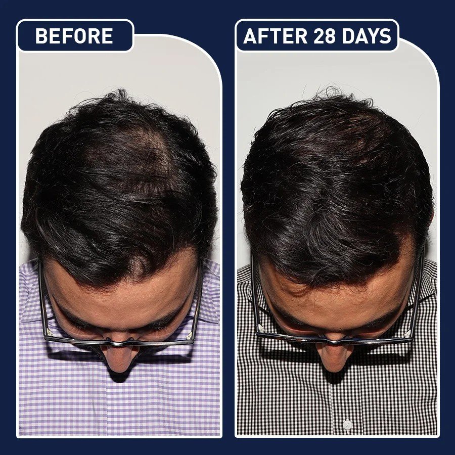 البخاخ الأمريكي لنمو الشعر FEG - الصورة 5